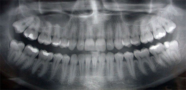 dental-xray.jpg